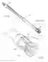 Fig. 43 - All in the head surface cleaning apparatus