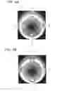 Fig. 06 - Image processing apparatus, image processing method, and endoscope