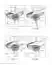 Fig. 02 - System and method of illumination of structures within an eye