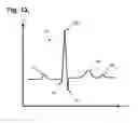Fig. 09 - System and method for applying a uniform dynamic gain over cardiac data with the aid of a digital computer