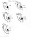 Fig. 29 - Devices, Methods, and Systems for Acquiring Medical Diagnostic Information and Provision of Telehealth Services