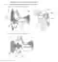 Fig. 32 - Devices, Methods, and Systems for Acquiring Medical Diagnostic Information and Provision of Telehealth Services