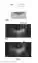 Fig. 07 - Optical tomography digital impression imaging system and method for use thereof