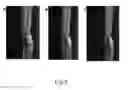 Fig. 09 - Optical tomography digital impression imaging system and method for use thereof