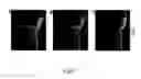 Fig. 10 - Optical tomography digital impression imaging system and method for use thereof
