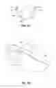Fig. 04 - Finger cuff having a shell