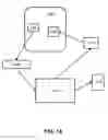Fig. 19 - Prevention of post-bariatric hypoglycemia using a novel glucose prediction algorithm and mini-dose stable glucagon