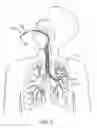 Fig. 03 - Methods and systems for endobronchial diagnostics