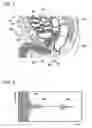Fig. 06 - URINE AMOUNT ESTIMATION DEVICE AND URINE AMOUNT ESTIMATION METHOD