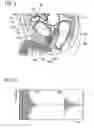 Fig. 07 - URINE AMOUNT ESTIMATION DEVICE AND URINE AMOUNT ESTIMATION METHOD