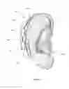 Fig. 12 - Sensor and apparatus for measurement of muscle activity in the detection and treatment of Bruxism Disorder