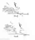 Fig. 06 - Electrode assembly with thread electrode