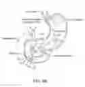 Fig. 09 - Swallowable capsule, system and method for measuring gastric emptying parameters