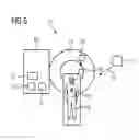 Fig. 05 - Method for generating a medical data set of a moving body part