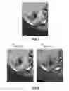 Fig. 08 - Method for standardizing target lesion selection and tracking on medical images