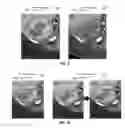 Fig. 09 - Method for standardizing target lesion selection and tracking on medical images