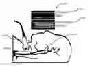 Fig. 01 - Systems and methods for automated fluid response measurement