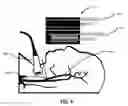 Fig. 05 - Systems and methods for automated fluid response measurement