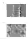 Fig. 02 - Echogenic article with compound indentations