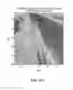 Fig. 23 - Systems and methods for automated fluid response measurement