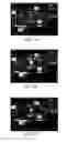 Fig. 11 - Detection of immobilized contrast agent with dynamic thresholding
