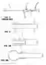 Fig. 03 - Systems, methods, and devices for fallopian tube diagnostics