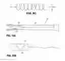 Fig. 07 - Systems, methods, and devices for fallopian tube diagnostics