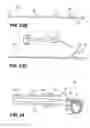 Fig. 16 - Systems, methods, and devices for fallopian tube diagnostics