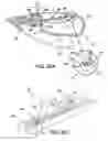 Fig. 18 - Systems, methods, and devices for fallopian tube diagnostics