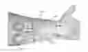 Fig. 01 - Surgical retractor