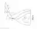 Fig. 16 - Locking suture construct