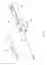 Fig. 14 - Knotless instability suture anchor construct and system