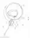 Fig. 19 - Knotless instability suture anchor construct and system