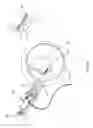 Fig. 21 - Knotless instability suture anchor construct and system