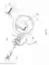 Fig. 22 - Knotless instability suture anchor construct and system