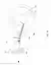 Fig. 28 - Knotless instability suture anchor construct and system