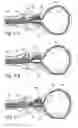 Fig. 03 - Devices, systems and methods for treating benign prostatic hyperplasia and other conditions