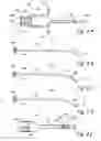 Fig. 09 - Devices, systems and methods for treating benign prostatic hyperplasia and other conditions