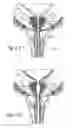 Fig. 15 - Devices, systems and methods for treating benign prostatic hyperplasia and other conditions