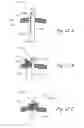 Fig. 24 - Devices, systems and methods for treating benign prostatic hyperplasia and other conditions