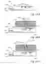 Fig. 29 - Devices, systems and methods for treating benign prostatic hyperplasia and other conditions