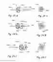 Fig. 32 - Devices, systems and methods for treating benign prostatic hyperplasia and other conditions