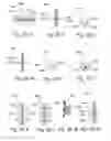 Fig. 36 - Devices, systems and methods for treating benign prostatic hyperplasia and other conditions