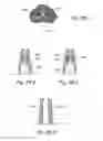 Fig. 43 - Devices, systems and methods for treating benign prostatic hyperplasia and other conditions