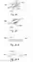 Fig. 49 - Devices, systems and methods for treating benign prostatic hyperplasia and other conditions