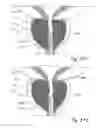 Fig. 53 - Devices, systems and methods for treating benign prostatic hyperplasia and other conditions