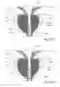 Fig. 56 - Devices, systems and methods for treating benign prostatic hyperplasia and other conditions