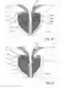Fig. 57 - Devices, systems and methods for treating benign prostatic hyperplasia and other conditions
