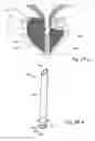 Fig. 58 - Devices, systems and methods for treating benign prostatic hyperplasia and other conditions