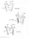 Fig. 14 - Counter-torque implant